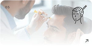 PRP Treatment
